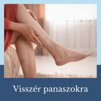 Visszér panaszokra